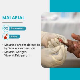 FMD Malarial Test